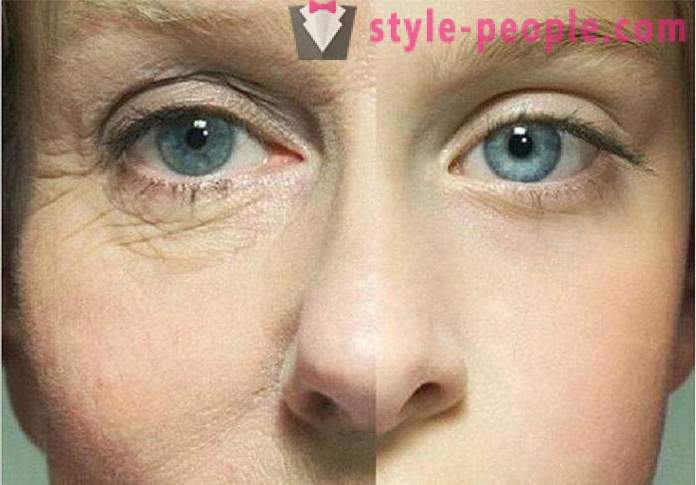 La heparina ungüento de las arrugas debajo de los ojos: opiniones, características y eficiencia de la aplicación