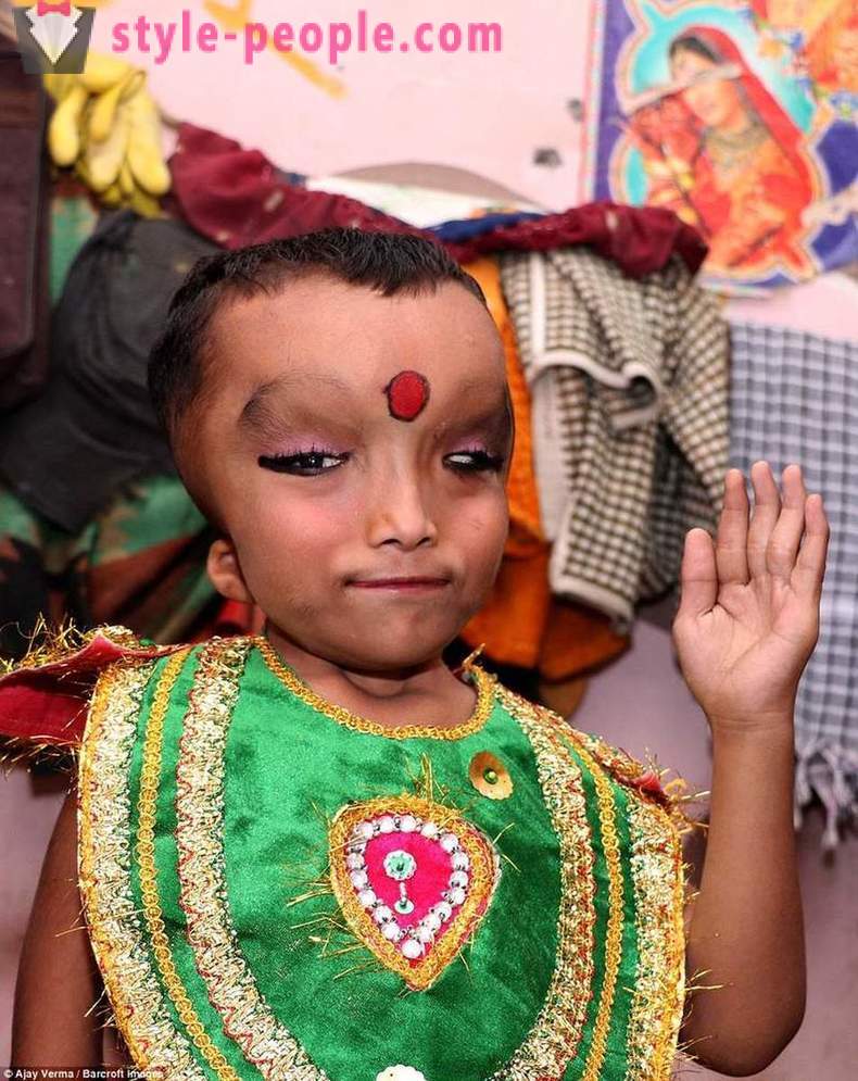 El pueblo indio es adorado niño con una cabeza deforme como un dios Ganesha