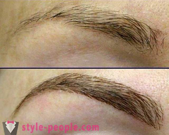 Método de acumulación de pelo de las cejas. Beneficios, costos y disponibilidad
