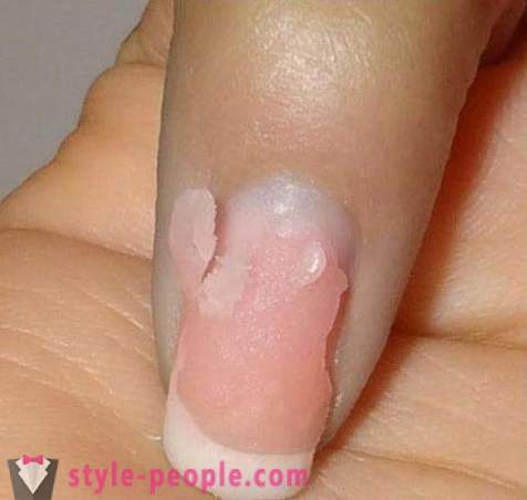 Cómo quitar las uñas de acrílico en casa? La eliminación de las uñas de acrílico: opiniones